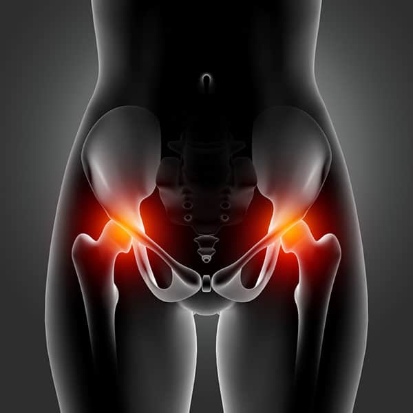 pelvic-inflammatory-disease