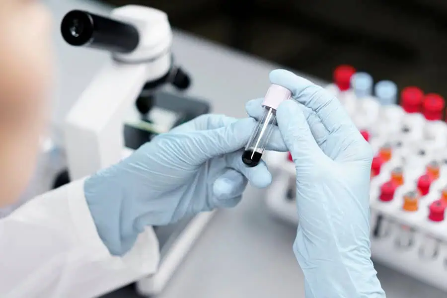 STD-testing-in-Miami-Lakes